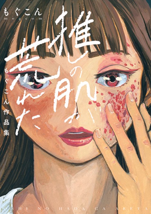 推しの肌が荒れた もぐこん作品集