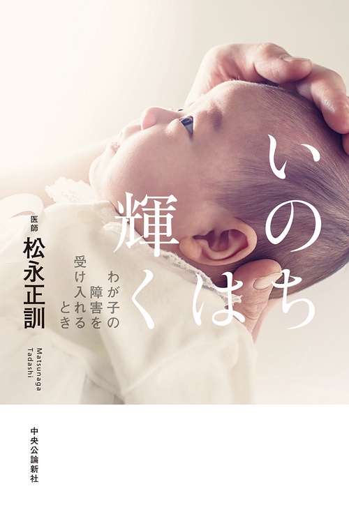 いのちは輝く わが子の障害を受け入れるとき