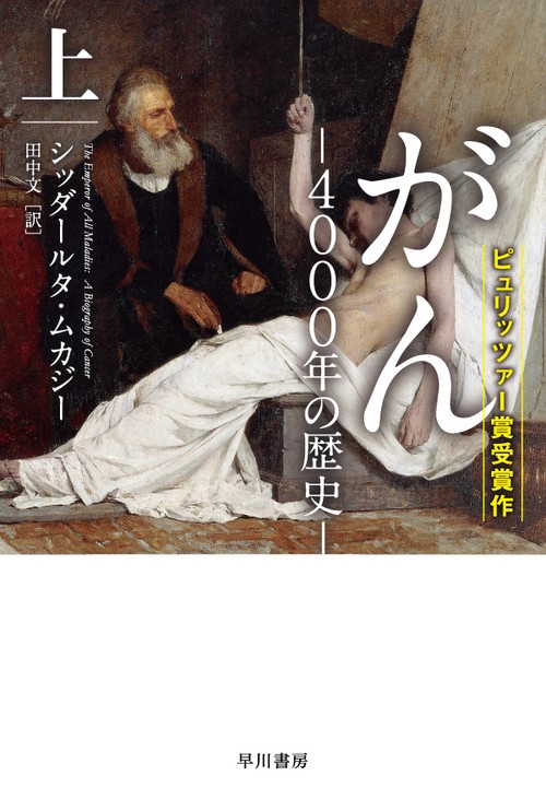 がん‐4000年の歴史‐ 上
