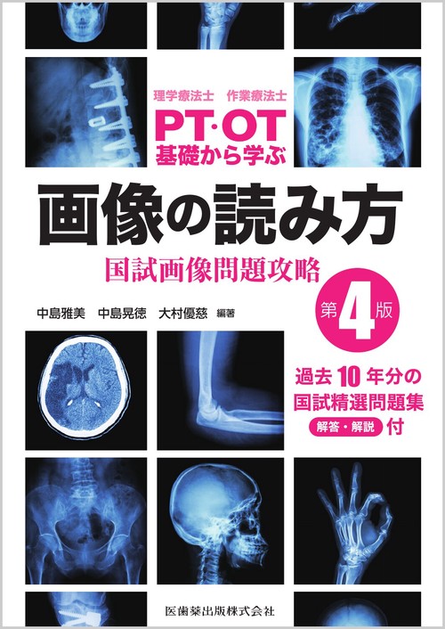理学療法士・作業療法士 PT・OT基礎から学ぶ画像の読み方第4版 国試画像問題攻略