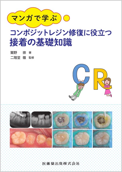 マンガで学ぶ コンポジットレジン修復に役立つ接着の基礎知識