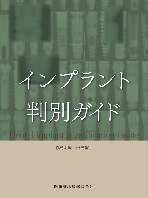 インプラント判別ガイド