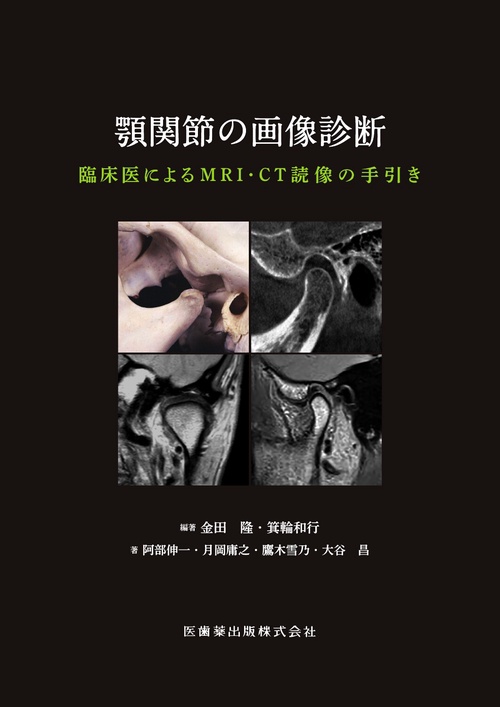 顎関節の画像診断