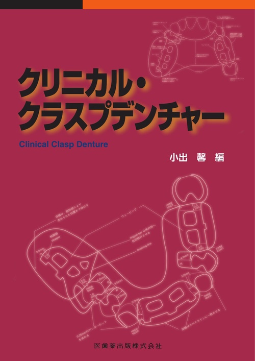 クリニカル・クラスプデンチャー