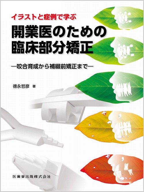 イラストと症例で学ぶ 開業医のための臨床部分矯正