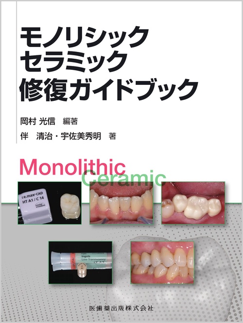 モノリシックセラミック修復ガイドブック