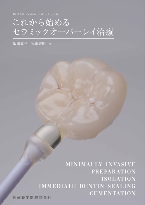 これから始めるセラミックオーバーレイ治療