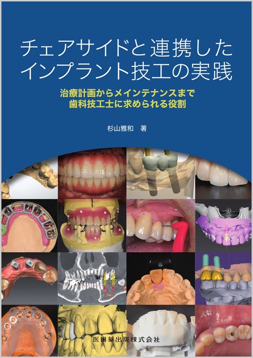 チェアサイドと連携したインプラント技工の実践