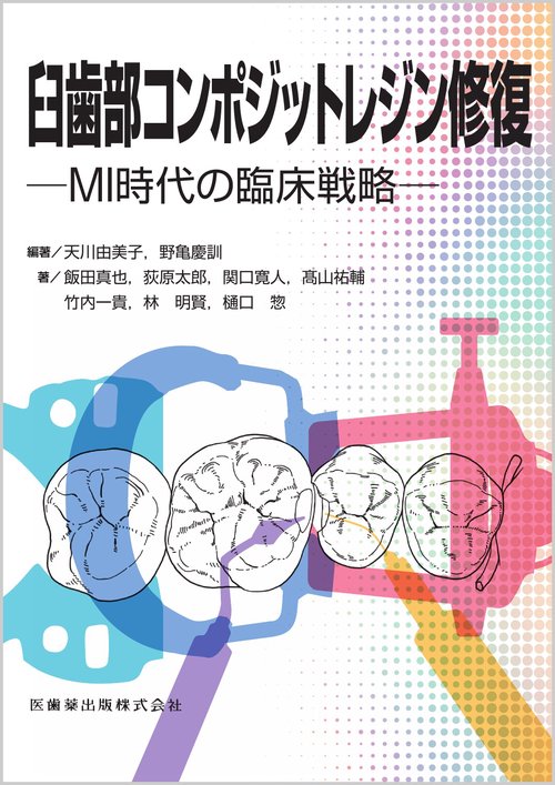臼歯部コンポジットレジン修復