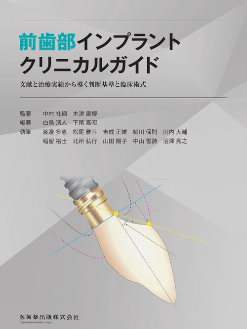 前歯部インプラントクリニカルガイド
