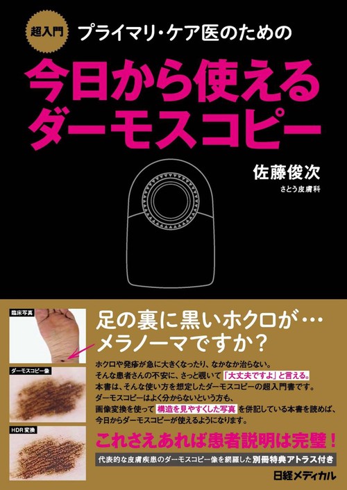 プライマリ・ケア医のための今日から使えるダーモスコピー 超入門