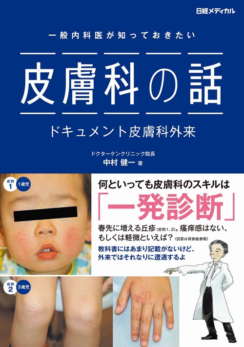 一般内科医が知っておきたい　皮膚科の話