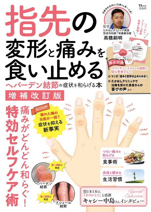 指先の変形と痛みを食い止める ヘバーデン結節の症状を和らげる本 増補改訂版