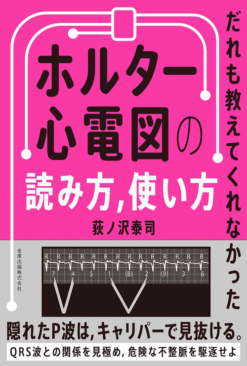 だれも教えてくれなかった ホルター心電図の読み方，使い方
