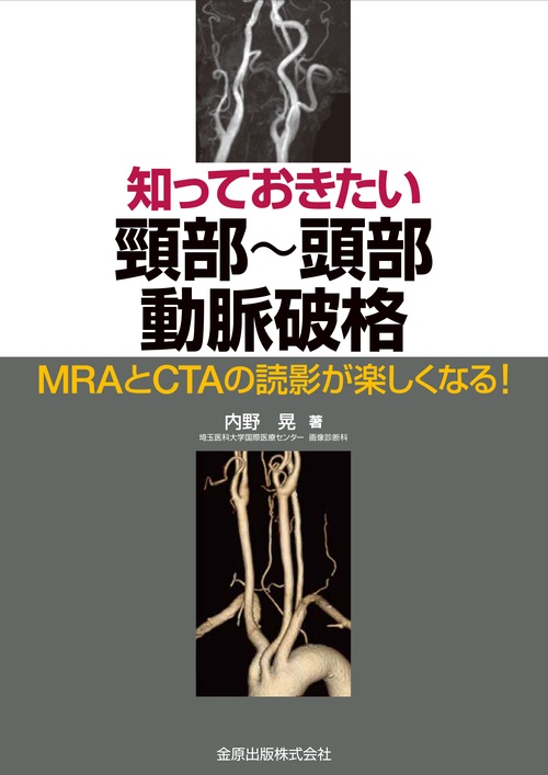 知っておきたい頸部頭部動脈破格