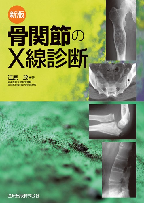 骨関節のX線診断