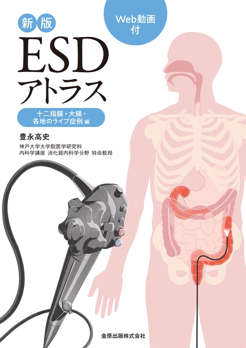 新版ESDアトラス 十二指腸・大腸・各地のライブ症例編