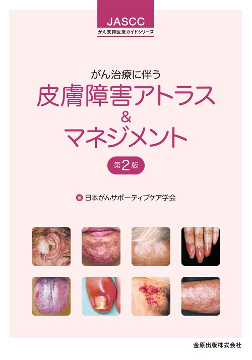 がん治療に伴う皮膚障害アトラス＆マネジメント 第2版