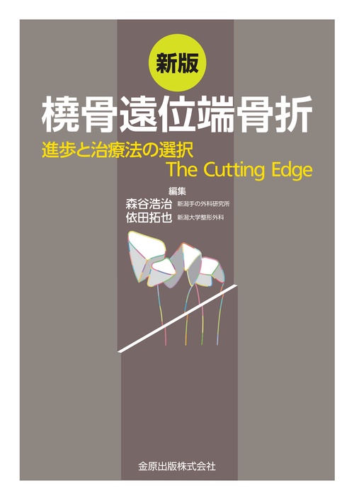 新版 橈骨遠位端骨折