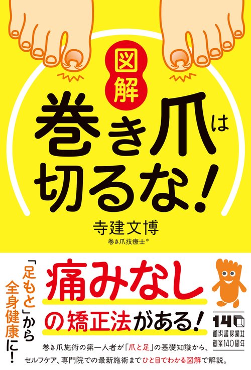 図解　巻き爪は切るな！