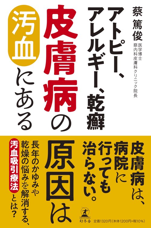 アトピー、アレルギー、乾癬 皮膚病の原因は汚血にある