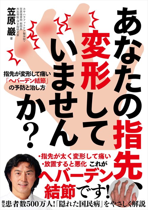 あなたの指先、変形していませんか? 指先が変形して痛い「ヘバーデン結節」の予防と治し方