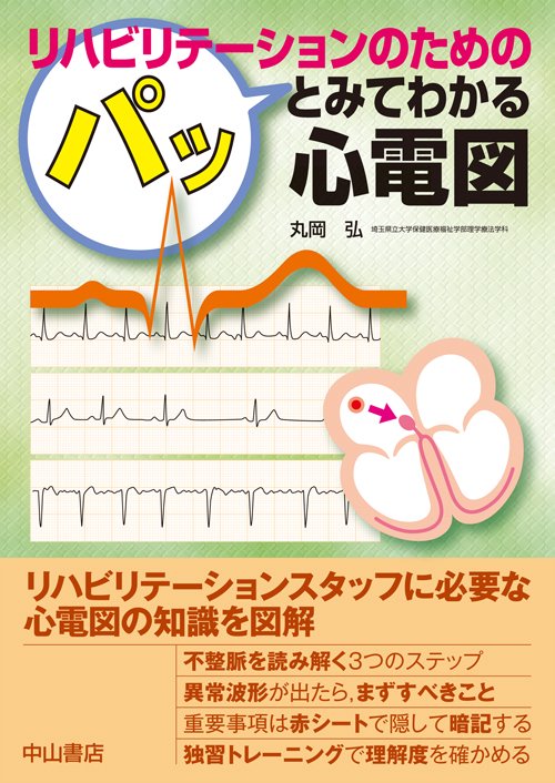 リハビリテーションのためのパッとみてわかる心電図
