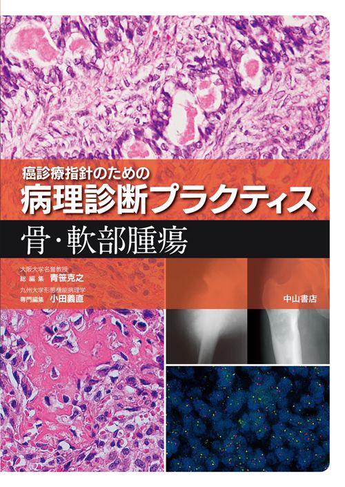 骨・軟部腫瘍