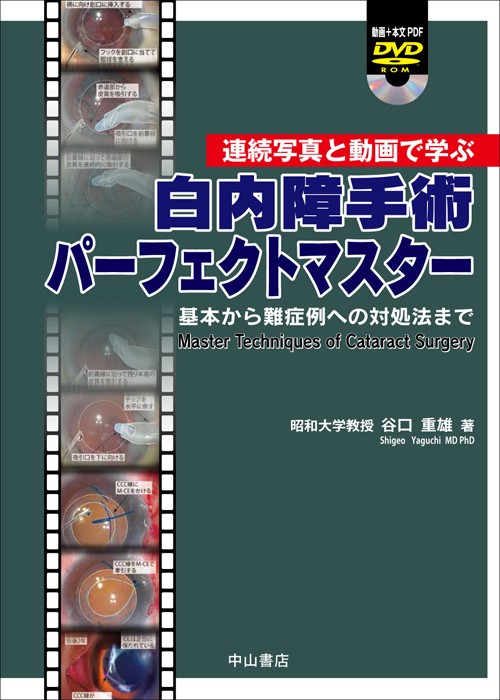 白内障手術パーフェクトマスター 基本から難症例への対処法まで 連続写真と動画で学ぶ