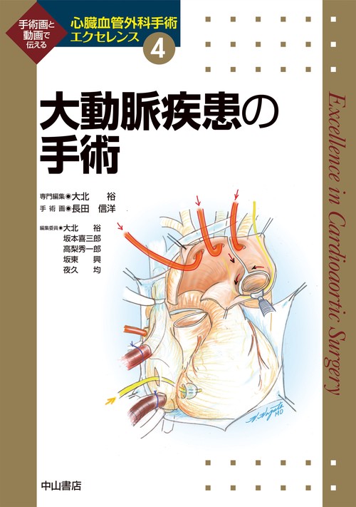 大動脈疾患の手術