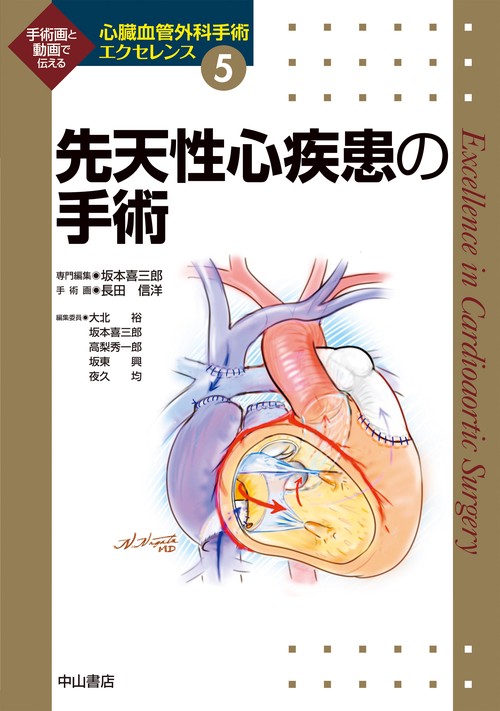 先天性心疾患の手術
