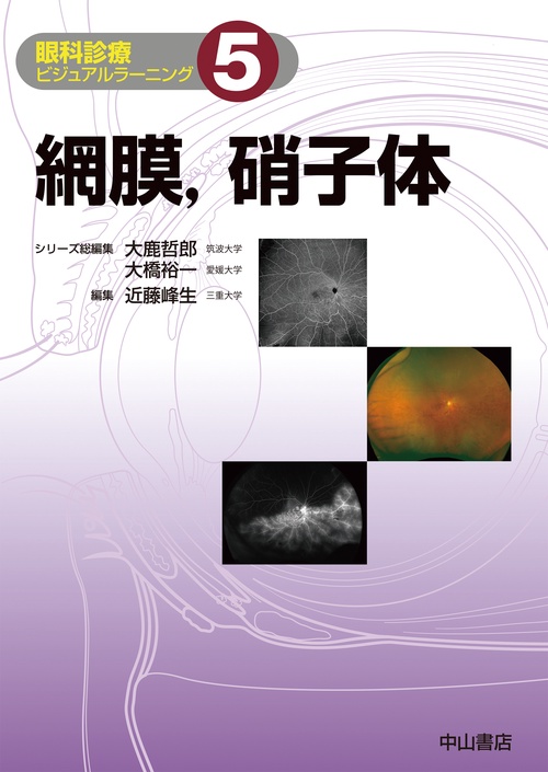網膜，硝子体