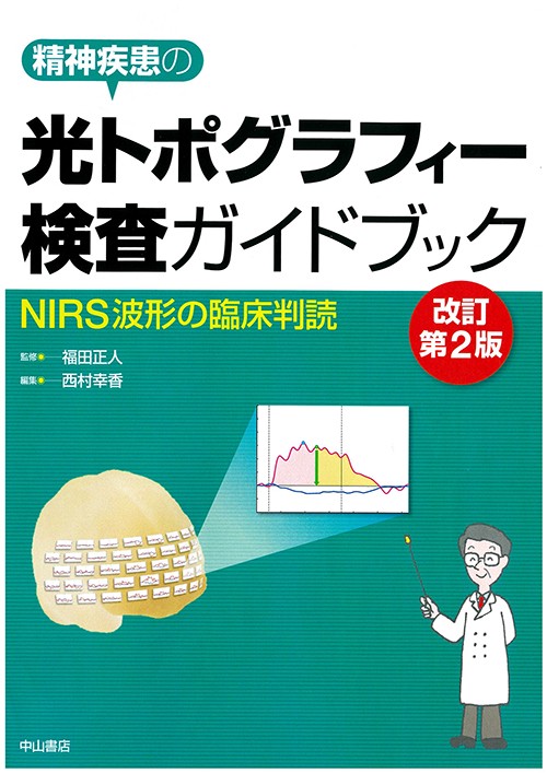光トポグラフィー検査ガイドブック 精神疾患の NIRS波形の臨床判読