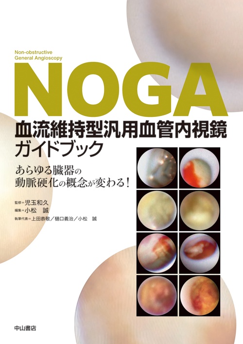 NOGA血流維持型汎用血管内視鏡ガイドブック　あらゆる臓器の動脈硬化の概念が変わる！