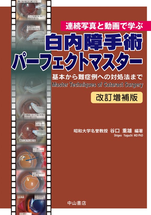 連続写真と動画で学ぶ　白内障手術パーフェクトマスター　基本から難症例への対処法まで