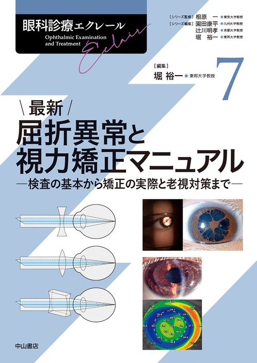 最新 屈折異常と視力矯正マニュアル 7巻