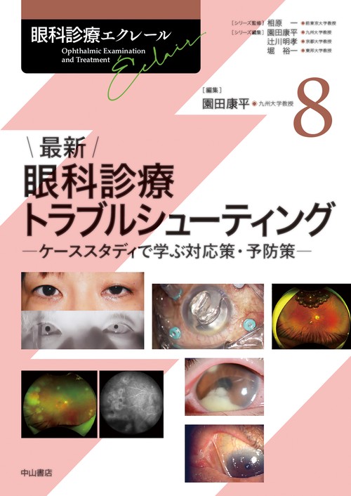 最新 眼科診療トラブルシューティング 第8巻