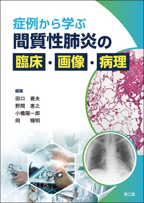 症例から学ぶ 間質性肺炎の臨床・画像・病理