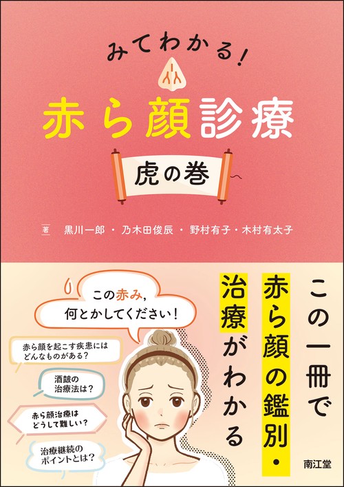 みてわかる！赤ら顔診療 虎の巻