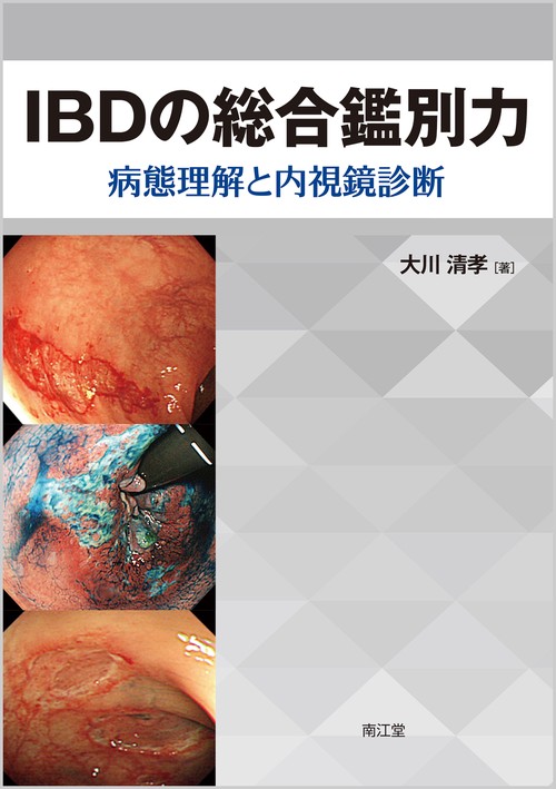 IBDの総合鑑別力