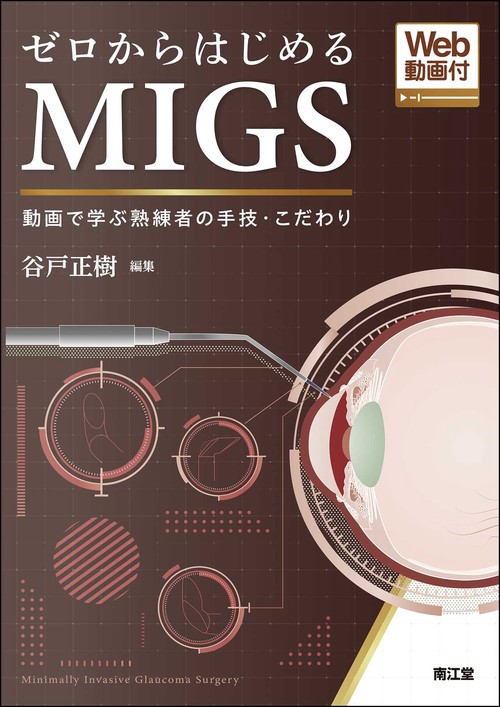 ゼロからはじめるMIGS［Web動画付］