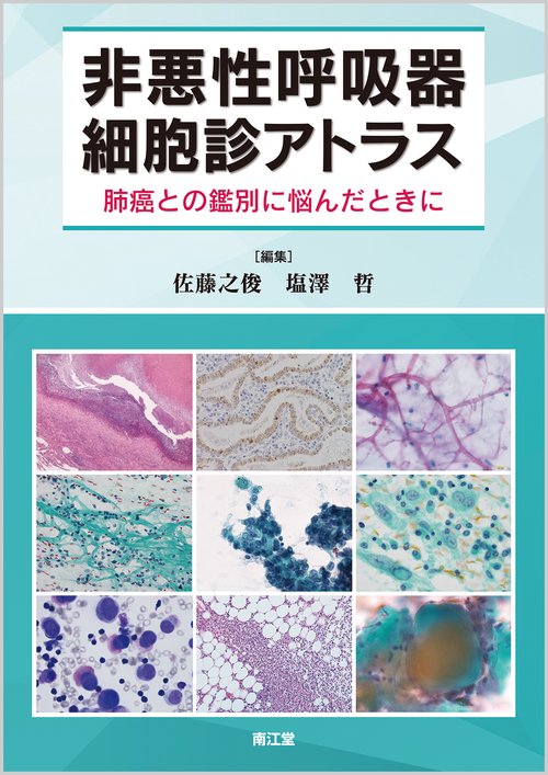 非悪性呼吸器細胞診アトラス