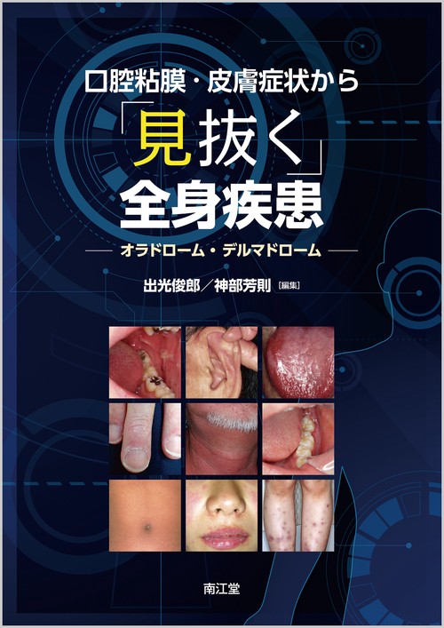 口腔粘膜・皮膚症状から「見抜く」全身疾患