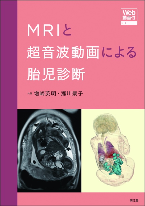 MRIと超音波動画による胎児診断［Web動画付］
