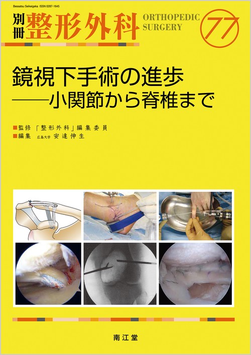 鏡視下手術の進歩