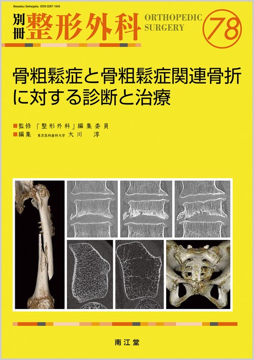骨粗鬆症と骨粗鬆症関連骨折に対する診断と治療
