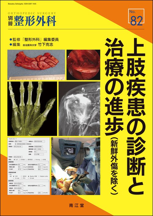 上肢疾患の診断と治療の進歩（新鮮外傷を除く）