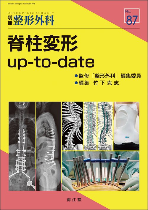 脊柱変形 up-to-date