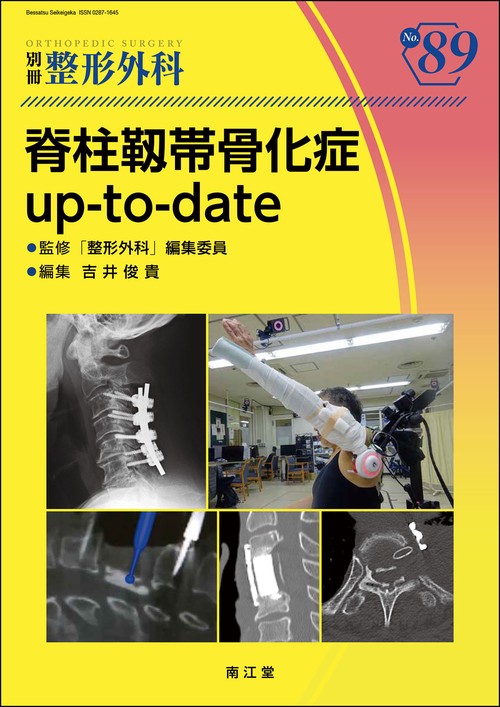 脊柱靱帯骨化症up-to-date