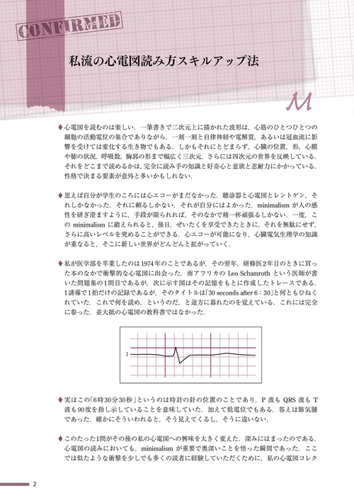 エキスパートはここを見る　心電図読み方の極意
